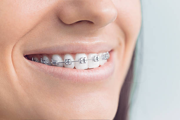 Best Invisalign and Clear Aligners  in Bonner Springs, KS